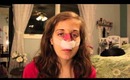 ♡ Nose Job Vlog: Part 1 ♡