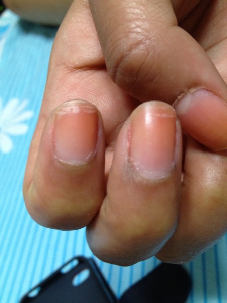 What s Wrong With My Nails Beautylish