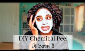 DIY CHEMICAL Facial Peel & Chat!