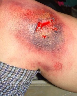Special FX makeup applied to the knee area