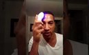 LED Skin Device you MUST GET for acne!