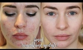 FINAL 8 MONTH ROACCUTANE UPDATE!