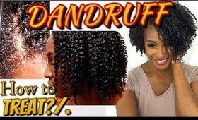 GIRL... IS THAT DANDRUFF?/.?/. | HOW TO TREAT DANDRUFF WITH SOULTANICLS | Shlinda1