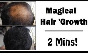 Quick Hair Growth - (Powder) *TEMPORARY*  - Hair Thinning Treatment || SuperwowStyle Prachi
