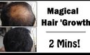 Quick Hair Growth - (Powder) *TEMPORARY*  - Hair Thinning Treatment || SuperwowStyle Prachi