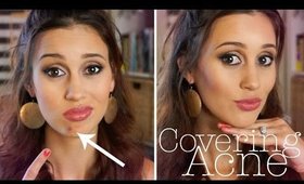 How to Cover a Pimple FLAWLESSLY!