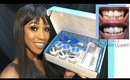 How I Got White Teeth | Smile Brilliant System GIVEAWAY!! (OPEN)