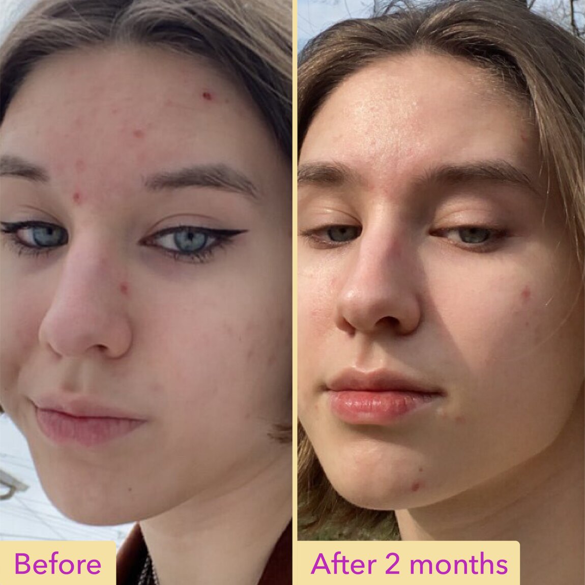 Good Molecules Niacinamide Serum packaging and bottle