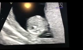 12w4d ultrasound :)