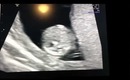 12w4d ultrasound :)
