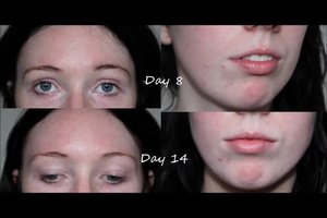 My second week update of using the Clinique Anti Blemish Solutions 3 Step System.
Check out my progress in my videos on my youtube channel: www.youtube.com/chloeluckinphotos