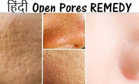 How to Get Rid of Large Pores Naturally _ HINDI #6  | SuperWowStyle _ DIY Smoother Tighter Skin