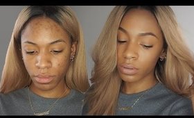 Long Lasting Dark Spot Coverage for Face & Body | VICKYLOGAN