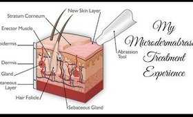 My Microdermabrasion Treatment Experience