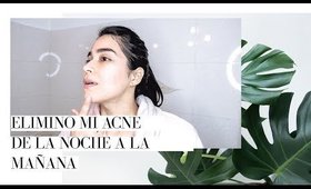 CÓMO SECAR ACNE DE LA NOCHE A LA MAÑANA | COSRX Acne Pimple Master Patch