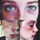 Facial Bruising and Bleeding SFX Makeup (Part 2)