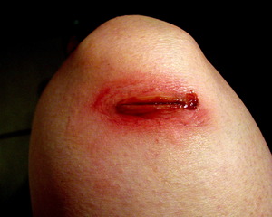 Practica heridas basicas
Alter Maquillaje Profesional
www.facebook.com/AlterMaquillaje