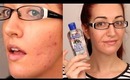REDUCE REDNESS FROM PIMPLES FAST! My Top 3 Tips! *REQUESTED!*