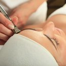 Laser Clinic in Adelaide Is the New Generation Treatment