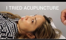 COME WITH ME! TRYING ACUPUNCTURE FOR THE FIRST TIME | Thefabzilla