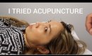 COME WITH ME! TRYING ACUPUNCTURE FOR THE FIRST TIME | Thefabzilla