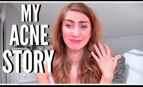 My Acne Story