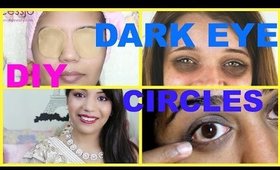 How to Get Rid of Dark Circles IMMEDIATELY FAST Naturally at Home ,SuperPrincessjo