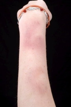 Bruises achieved with cream colors during makeup school.