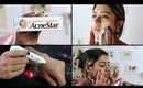 Acnestar Gel Review _ HOW TO REALLY GET RID OF ACNE | SuperWowStyle Prachi