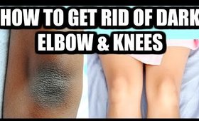 How To Get Rid Of Black Elbows & Knees Fast | SuperPrincessjo