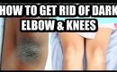 How To Get Rid Of Black Elbows & Knees Fast | SuperPrincessjo