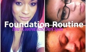 Foundation Routine for Acne/Dark Spots