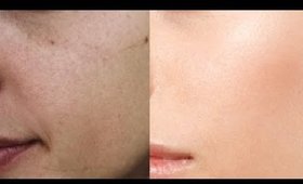 How to Get  CLEAR GLOWING, SPOTLESS Skin? _  |  Skin POLISH, Spot & Pimple Cleaning - SuperWowStyle