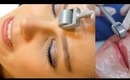best way to get acne free skin using a derma roller + c boost from 302 skincare