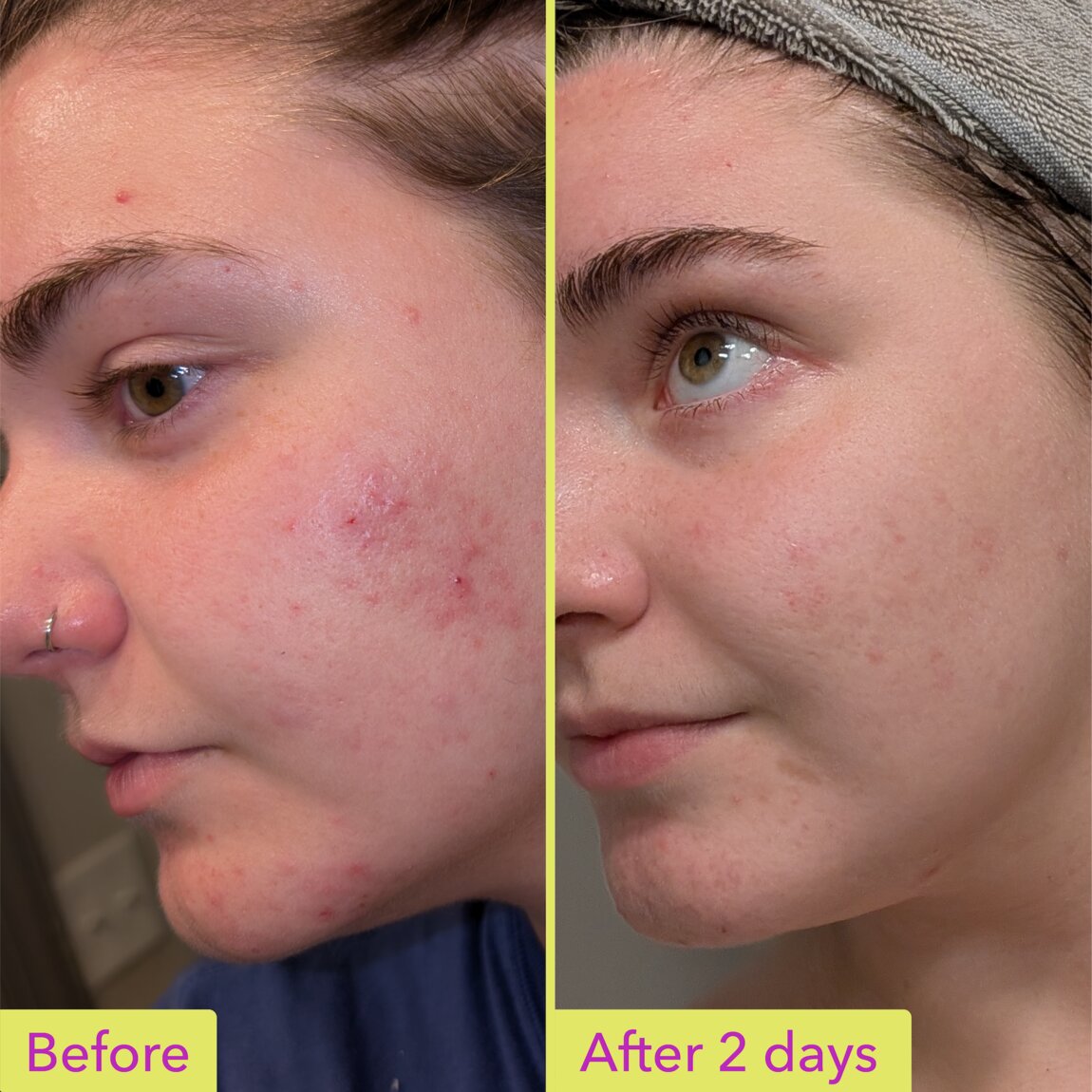 glutathione vitamin c and zinc injection IV Therapy, Infusions & Vitamin Injections | Morgantown WV | Almost Heaven  Hydration