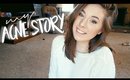 My Acne Story + An Exciting Announcement