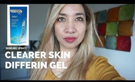 ACNE TREATMENT DIFFERIN GEL | Skincare Update