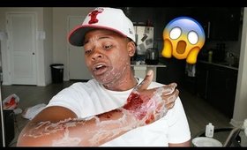 DISGUSTING DEAD SKIN PRANK!!!!!!