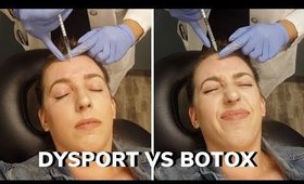 DYSPORT VS BOTOX 💉 CROW'S FEET, FOREHEAD, 11s, BEFORE & AFTER, DOES IT WORK, PAIN