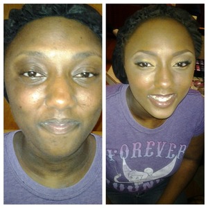 Client has severe case of eczema, color correction and blending provides a flawless finish