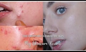 The Ordinary cleared My Skin | A 6 month Skincare Review