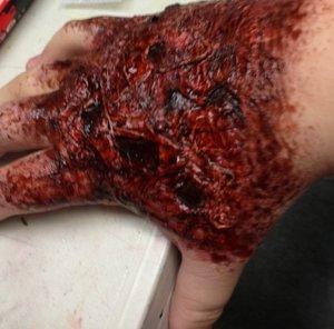 Burned hand sfx makeup