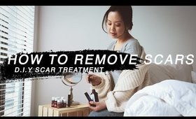 DIY ALL NATURAL SCAR TREATMENT