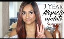 3 Year Alopecia Update