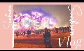 Sunburn for a Day | VLOG