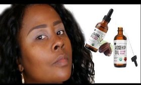 HOW I GET CLEAR SKIN | #nofilter | Skin care routine with Kate Blanc Cosmetics oil |Darbiedaymua