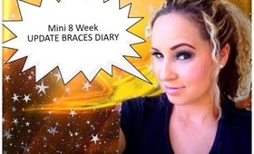 8 WEEK MINI BRACES DIARY UPDATE