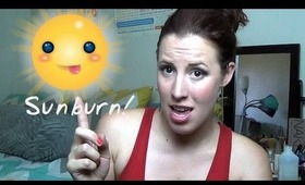 Avoiding Sunburn + How to Treat It