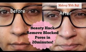 Beauty Hack ♡ Yay Or Nay Remove Blackheads w Baking Soda || Makeup With Raji