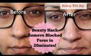 Beauty Hack ♡ Yay Or Nay Remove Blackheads w Baking Soda || Makeup With Raji